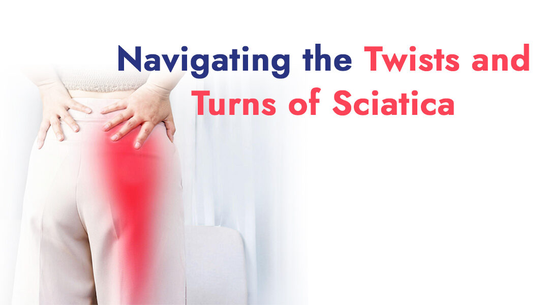 Navigating the Twists and Turns of Sciatica