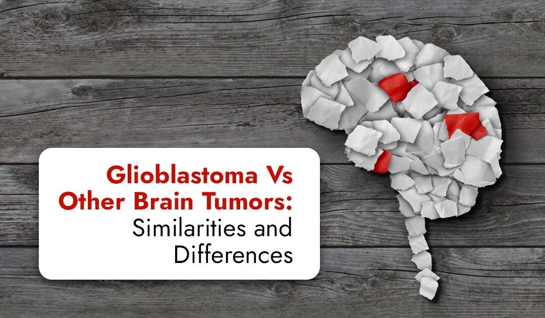 Glioblastoma Vs Other Brain Tumors: Similarities and Differences