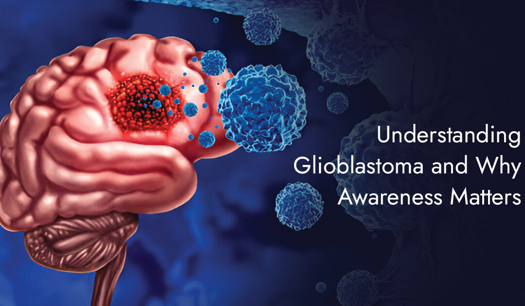 Understanding Glioblastoma and Why Awareness Matters