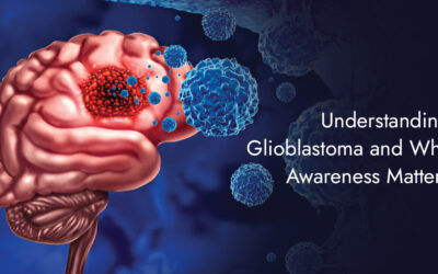 Understanding Glioblastoma and Why Awareness Matters