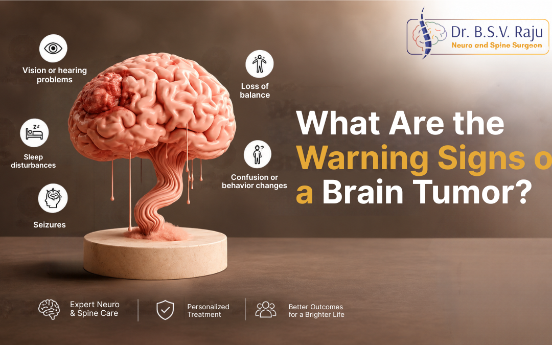 What Are the Warning Signs of a Brain Tumor?
