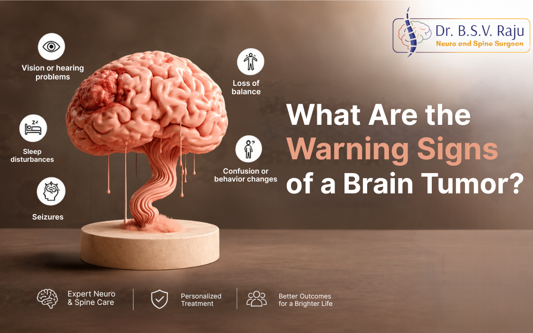 What Are the Warning Signs of a Brain Tumor?