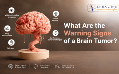 What Are the Warning Signs of a Brain Tumor?