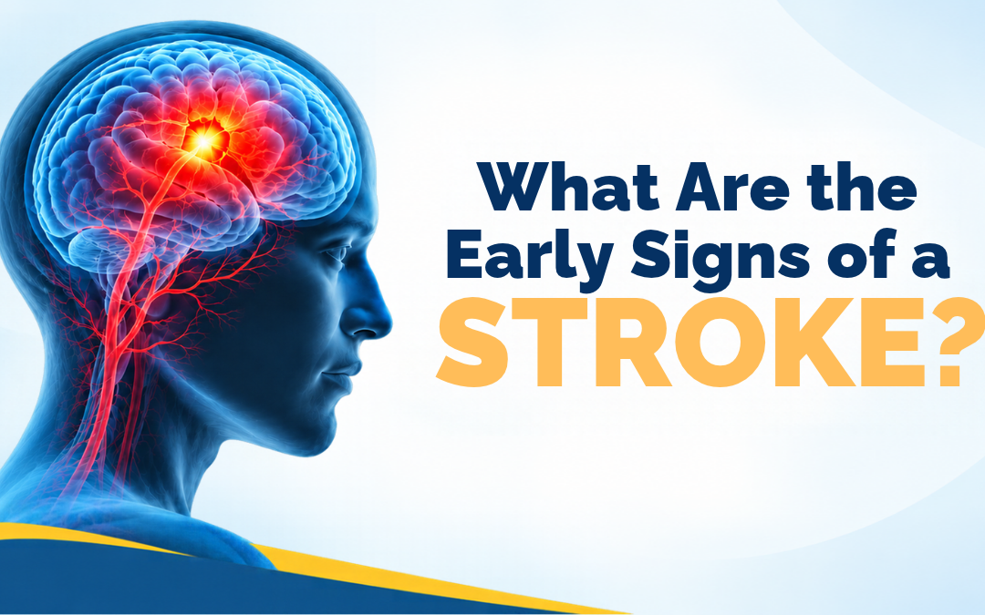 Early Signs of Stroke You Should Know
