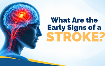 What Are the Early Signs of a Stroke?